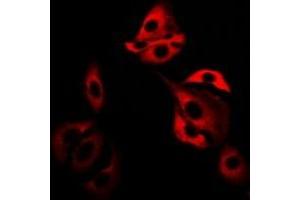 Immunofluorescent analysis of Glutaredoxin staining in SW480 cells. (Glutaredoxin 1 抗体)