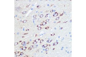 Immunohistochemistry of paraffin-embedded rat brain using GluR2/GRI Rabbit mAb (ABIN7267414) at dilution of 1:100 (40x lens). (GRIA2 抗体)