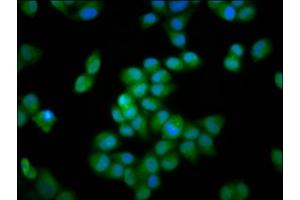 Immunofluorescence staining of Hela cells with ABIN7156413 at 1:66, counter-stained with DAPI. (INTS3 抗体  (AA 901-1043))