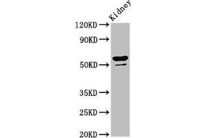 Western Blot Positive WB detected in: Rat kidney tissue All lanes: CYP8B1 antibody at 6. (CYP8B1 抗体  (AA 303-440))