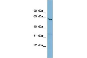 WB Suggested Anti-SLC25A21 Antibody Titration:  0. (SLC25A21 抗体  (Middle Region))
