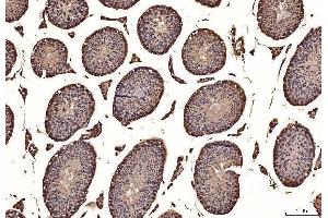 IHC analysis of NAK/TBK1 using anti-NAK/TBK1 antibody (ABIN7599532).