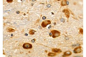 ABIN6257095 and ABIN6275980 at 1/100 staining Rat brain tissue by IHC-P. (CNR1 抗体  (N-Term))