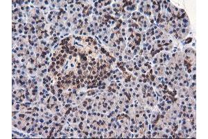 Image no. 4 for anti-F-Box Protein 21 (FBXO21) antibody (ABIN1498232) (FBXO21 抗体)