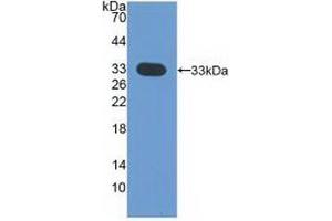 Western blot analysis of recombinant Human CDK4. (CDK4 抗体  (AA 6-295))