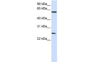 WB Suggested Anti-CCT7  Antibody Titration: 0. (CCT7 抗体  (Middle Region))