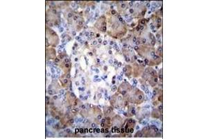 Immunohistochemistry (Paraffin-embedded Sections) (IHC (p)) image for anti-TIMP Metallopeptidase Inhibitor 1 (TIMP1) (AA 157-188), (C-Term) antibody (ABIN655149)