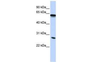 Image no. 1 for anti-Inhibin Binding Protein (INHBP) (C-Term) antibody (ABIN6743125) (IGSF1 抗体  (C-Term))