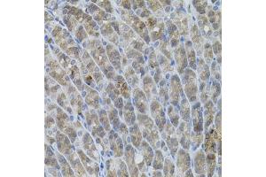 Immunohistochemistry of paraffin-embedded mouse stomach using UBE2A antibody (ABIN6132760, ABIN6149782, ABIN6149784 and ABIN6223686) (40x lens). (UBE2A 抗体  (AA 1-152))
