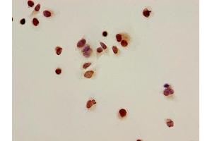 Immunocytochemistry analysis of Hela cells using ABIN7139166 at dilution of 1:100 (HIST1H2BB 抗体  (acLys16))