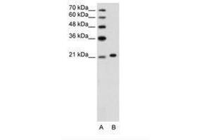 Image no. 3 for anti-Ankyrin 1, Erythrocytic (ANK1) (C-Term) antibody (ABIN203434) (Erythrocyte Ankyrin 抗体  (C-Term))