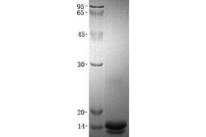 Validation with Western Blot (CCL16 蛋白)