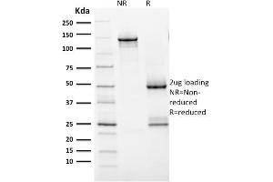 SDS-PAGE (SDS) image for anti-Receptor tyrosine-protein kinase erbB-2 (ErbB2/Her2) (AA 311-462) antibody (ABIN6939316)