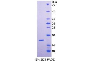 SDS-PAGE analysis of Human GCA Protein.