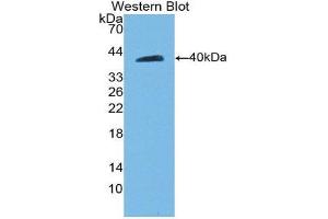 Western Blotting (WB) image for anti-Cadherin 5 (CDH5) (AA 59-382) antibody (ABIN1858328) (Cadherin 5 抗体  (AA 59-382))