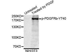 Western blot analysis of extracts of NIH/3T3 cells, using Phospho-PDGFRb-Y740 antibody. (PDGFRB 抗体)