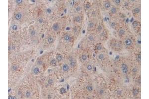 Detection of FLNC in Human Liver Tissue using Polyclonal Antibody to Filamin C Gamma (FLNC) (FLNC 抗体  (AA 17-259))