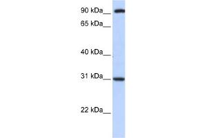 WB Suggested Anti-ANKRA2 Antibody Titration:  0. (ANKRA2 抗体  (C-Term))