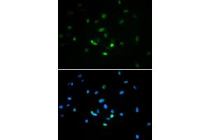 Immunofluorescence analysis of MCF-7 cells using TP53 antibody (ABIN5971632). (p53 抗体)