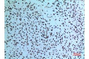 Immunohistochemistry (IHC) image for anti-Keratin 14 (KRT14) (C-Term) antibody (ABIN3187714)