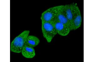 Hela cells were stained with Smad2 (9A3) Monoclonal Antibody  at [1:200] incubated for overnight at 4C followed by secondary antibody incubation, DAPI staining of the nuclei and detection. (SMAD2 抗体)