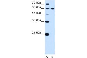 Western Blotting (WB) image for anti-Deltex Homolog 2 (DTX2) antibody (ABIN2462679) (DTX2 抗体)