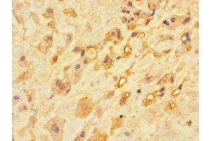 Immunohistochemistry of paraffin-embedded human placenta tissue using ABIN7146737 at dilution of 1:100 (CA11 抗体  (AA 24-328))
