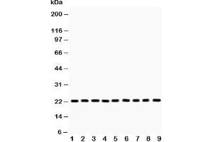 Western blot testing of PRDX1 antibody and Lane 1:  rat brain;  2: mouse brain;  3: human U87;  4: (m) Neuro-2a;  5: (h) A375;  6: (h) 293T;  7: (h) SMMC;  8: (h) A549;  9: (h) RH35 lysate. (Peroxiredoxin 1 抗体  (Middle Region))