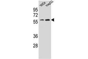 Western blot analysis of HOXA10 / HOX1H Antibody (Center) in WiDr, HepG2 cell line lysates (35ug/lane). (HOXA10 抗体  (Middle Region))