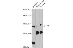Western blot analysis of extracts of various cell lines, using PZP antibody (ABIN1682416, ABIN3017699, ABIN3017700 and ABIN6220213) at 1:3000 dilution. (PZP 抗体  (AA 620-740))