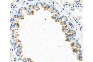 Immunohistochemistry of paraffin-embedded Mouse lung using GNRH2 Polyclonal Antibody at dilution of 1:100 (40x lens). (GnRH2 抗体)