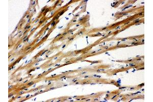 Immunohistochemistry (IHC) image for anti-Presenilin 2 (Alzheimer Disease 4) (PSEN2) (AA 39-51), (N-Term) antibody (ABIN3044383)