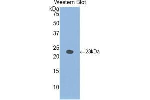 Detection of Recombinant GaA, Mouse using Polyclonal Antibody to Glucosidase Alpha, Acid (GaA) (GAA 抗体  (AA 755-953))