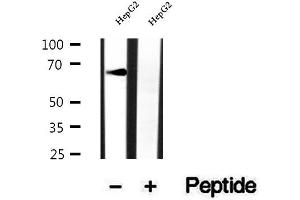 Western blot analysis of extracts of HepG2 cells, using RNF156 antibody. (Mahogunin RING Finger Protein 1 抗体  (Internal Region))