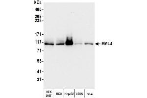 Western Blotting (WB) image for anti-Echinoderm Microtubule Associated Protein Like 4 (EML4) (AA 931-981) antibody (ABIN7454794) (EML4 抗体  (AA 931-981))