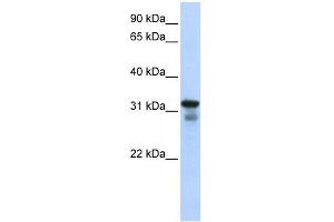 LAPTM4B antibody used at 1 ug/ml to detect target protein. (LAPTM4B 抗体  (Middle Region))