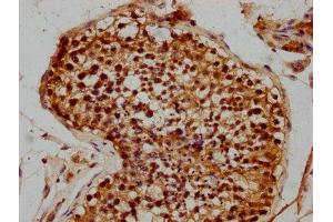 IHC image of ABIN7176072 diluted at 1:300 and staining in paraffin-embedded human testis tissue performed on a Leica BondTM system. (ZIM2 抗体  (AA 1-124))