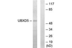 Western blot analysis of extracts from HepG2 cells, using UBXD5 Antibody. (UBXN11 抗体  (AA 131-180))