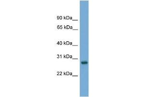 WB Suggested Anti-Abt1 Antibody Titration: 0.