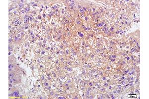 L1 human colon carcinoma lysates L2 rat brain lysates probed with Anti GPR15 Polyclonal Antibody, Unconjugated (ABIN702835) at 1:200 overnight at 4 °C. (GPR15 抗体  (AA 51-150))