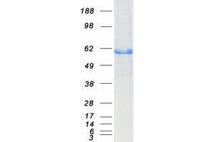 Western Blotting (WB) image for Aldehyde Dehydrogenase 2 Family (Mitochondrial) (ALDH2) protein (Myc-DYKDDDDK Tag) (ABIN2714541)