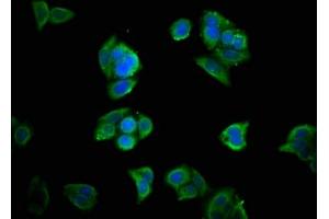 Immunofluorescence staining of PC-3 cells with ABIN7155709 at 1:33, counter-stained with DAPI. (Homeobox A11 抗体  (AA 115-176))