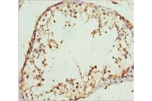 Immunohistochemistry of paraffin-embedded human testis tissue using ABIN7167019 at dilution of 1:100 (RACGAP1 抗体  (AA 353-632))