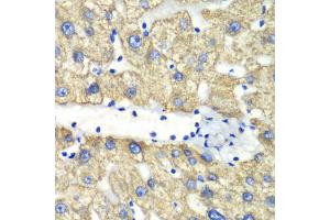 Immunohistochemistry of paraffin-embedded human liver injury using ABAT antibody (ABIN5973045) at dilution of 1/100 (40x lens). (ABAT 抗体)