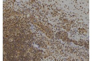 ABIN6273485 at 1/100 staining Human spleen tissue by IHC-P. (MAGED4B 抗体  (Internal Region))