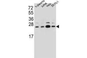 Western Blotting (WB) image for anti-Signal Sequence Receptor, beta (Translocon-Associated Protein Beta) (SSR2) antibody (ABIN2997190) (SSR2 抗体)