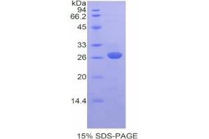 SDS-PAGE analysis of Mouse FATP5 Protein. (SLC27A5 蛋白)