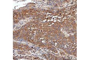 IHC analysis of PPP2CA using anti-PPP2CA antibody (ABIN3043356).