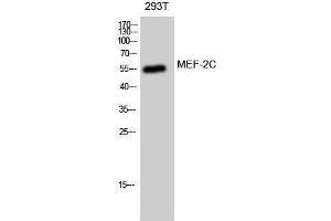 Western Blotting (WB) image for anti-Myocyte Enhancer Factor 2C (MEF2C) (Ser893) antibody (ABIN3175961) (MEF2C 抗体  (Ser893))