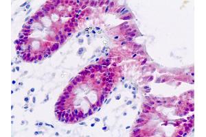 Human, Colon: Formalin-Fixed Paraffin-Embedded (FFPE)